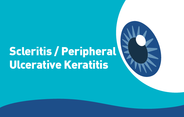 Scleritis / Peripheral Ulcerative Keratitis