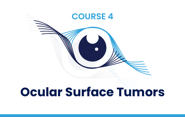Ocular Surface tumours