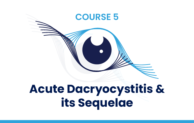 Acute Dacryocystitis & its Sequelae