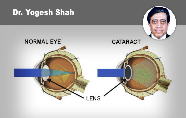 A to Z of Phacodynamics and  its Applications in different types of Cataracts