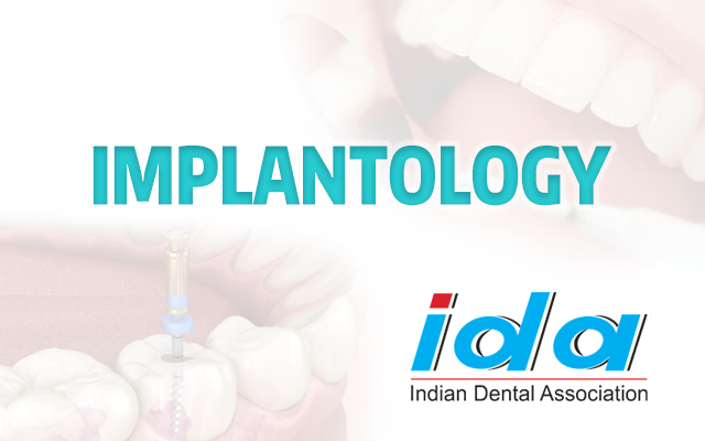 /asset-v1:IDA+IDA002+2020_Mar_IDA002+type@asset+block@Implantology-Course-Card.png