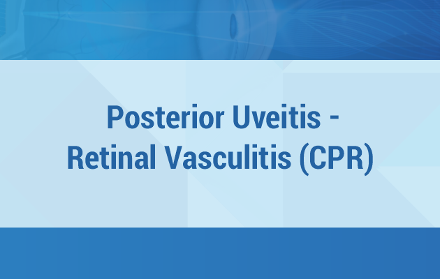 Posterior Uveitis - Retinal Vasculitis (CPR)