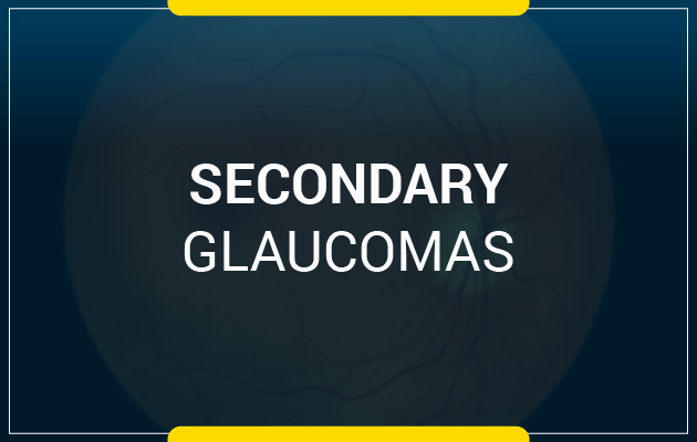 Secondary Glaucomas