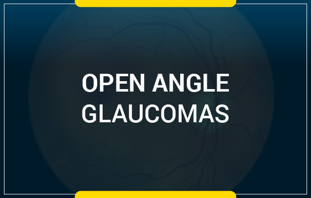 Open Angle Glaucomas
