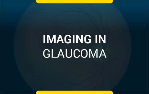 Imaging in Glaucoma