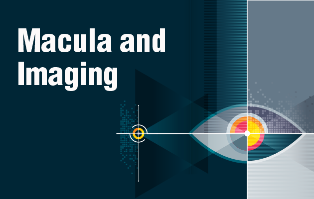 Macula and imaging
