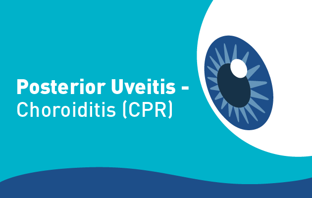 Posterior Uveitis - Choroiditis (CPR)