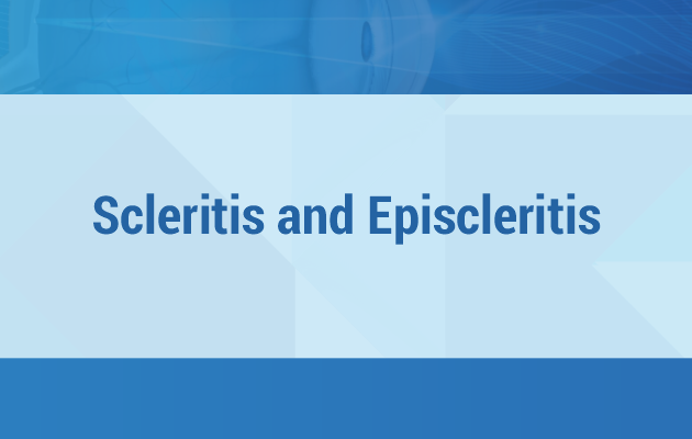 Scleritis and Episcleritis