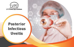 Posterior infectious uveitis