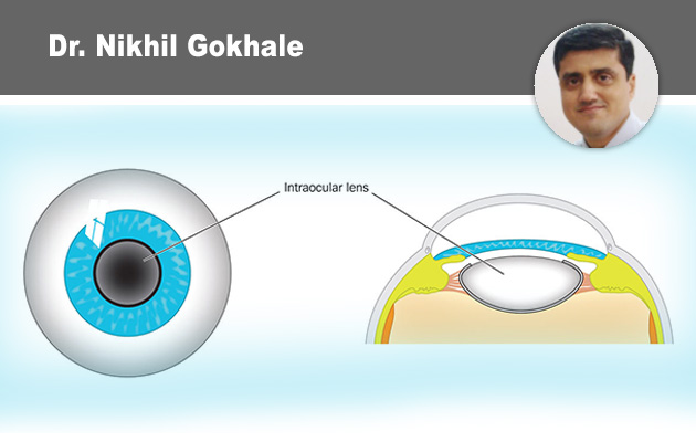 Practical Approach to Corneal Ulcers